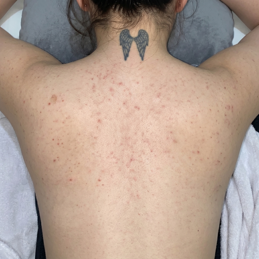 DAY 01 / Dull skin, dry patches — same crop